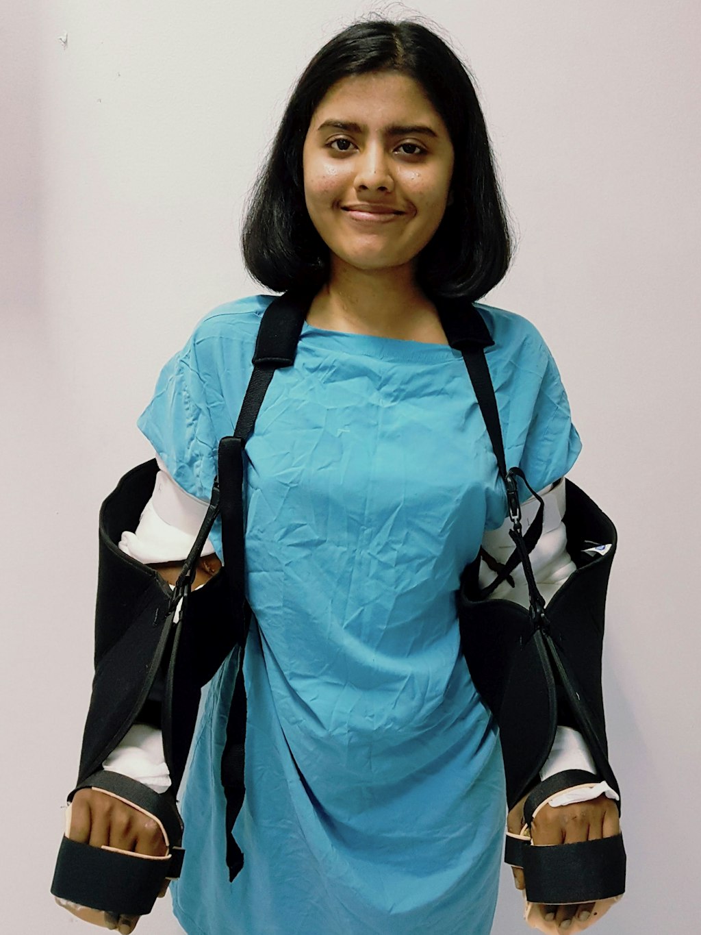 Shreya Siddanagowder (zu der Zeit 19) kurz nach der OP. Ihr Körper muss sich noch an die neuen Unterarme gewöhnen.