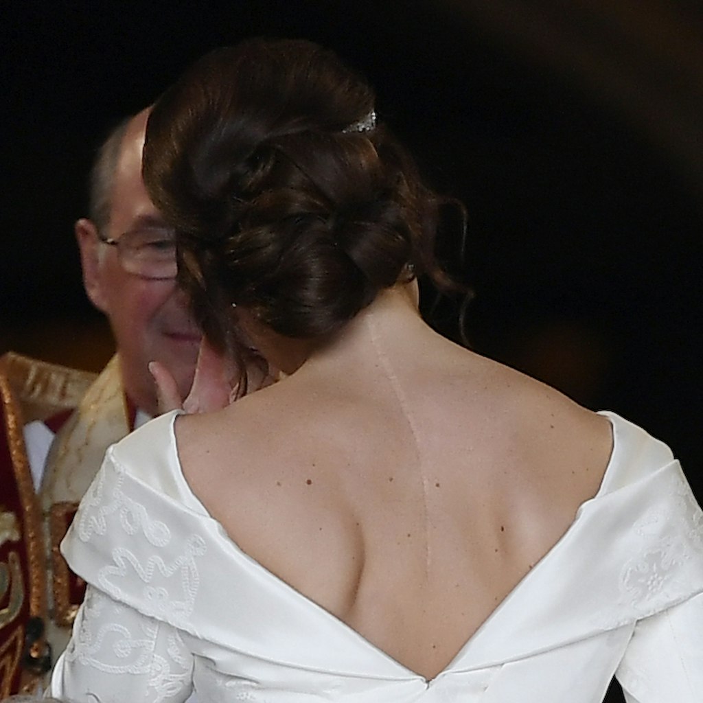 Nach einer Wirbelsäulen-Operation ziert eine große Narbe Eugenies Rücken. Die zeigte sie bei ihrer Hochzeit 2018.