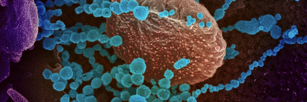 Coronavirus unter dem Mikroskop