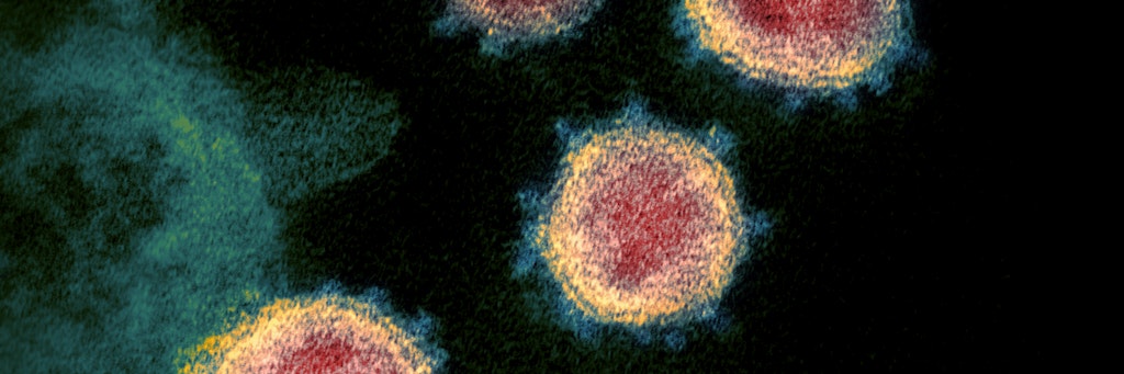 Zur Wirkung des Coronavirus im Körper wird fieberhaft geforscht.