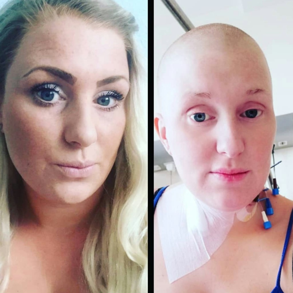 Nach einem großen Blutbild erhielt Aleena die niederschmetternde Diagnose: Leukämie.