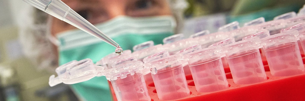 In mehr als 70 Laboren weltweit wird an der Entwicklung eines Corona-Impfstoffes geforscht.