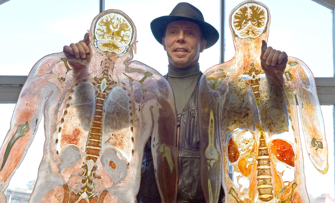 Gunther von Hagens Gruselauftrag an seine Ehefrau