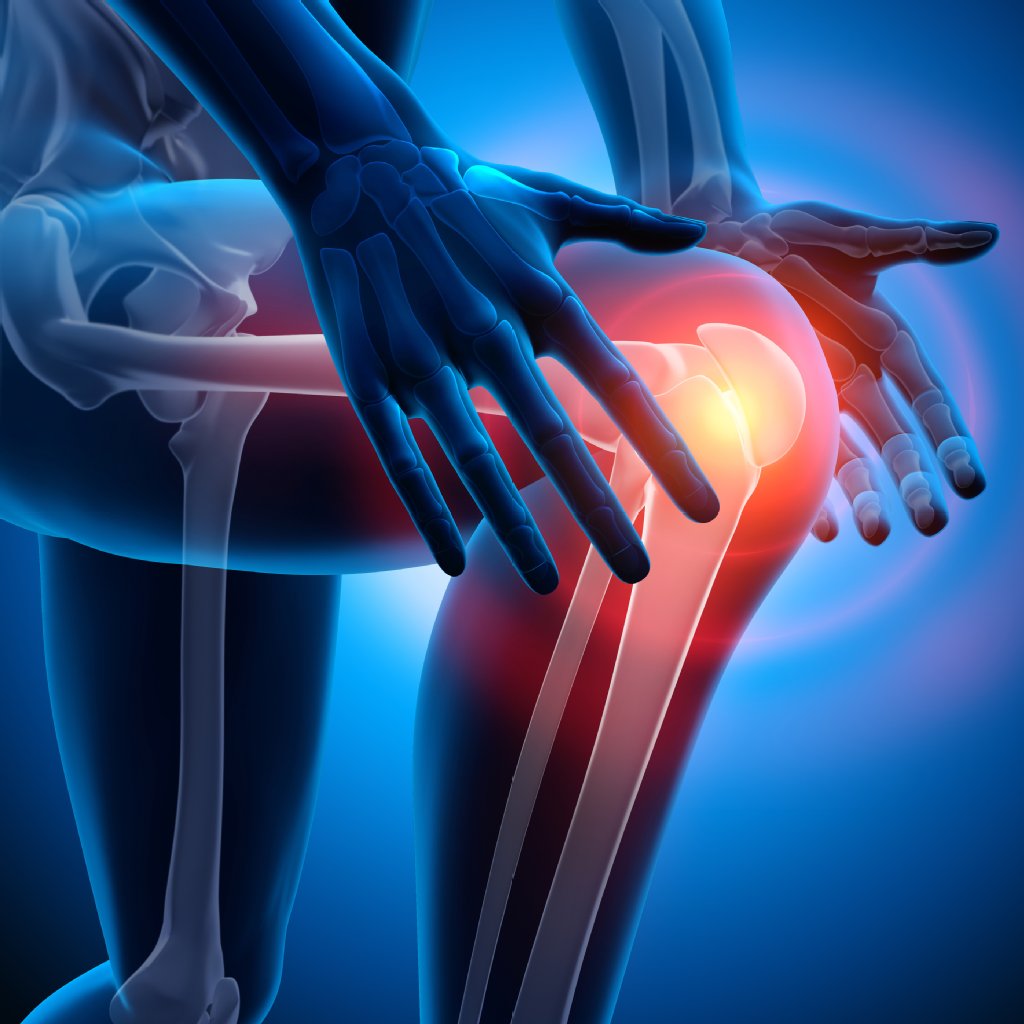 Kniegelenk: Arthrose: Wie sich das Knie verschleißt