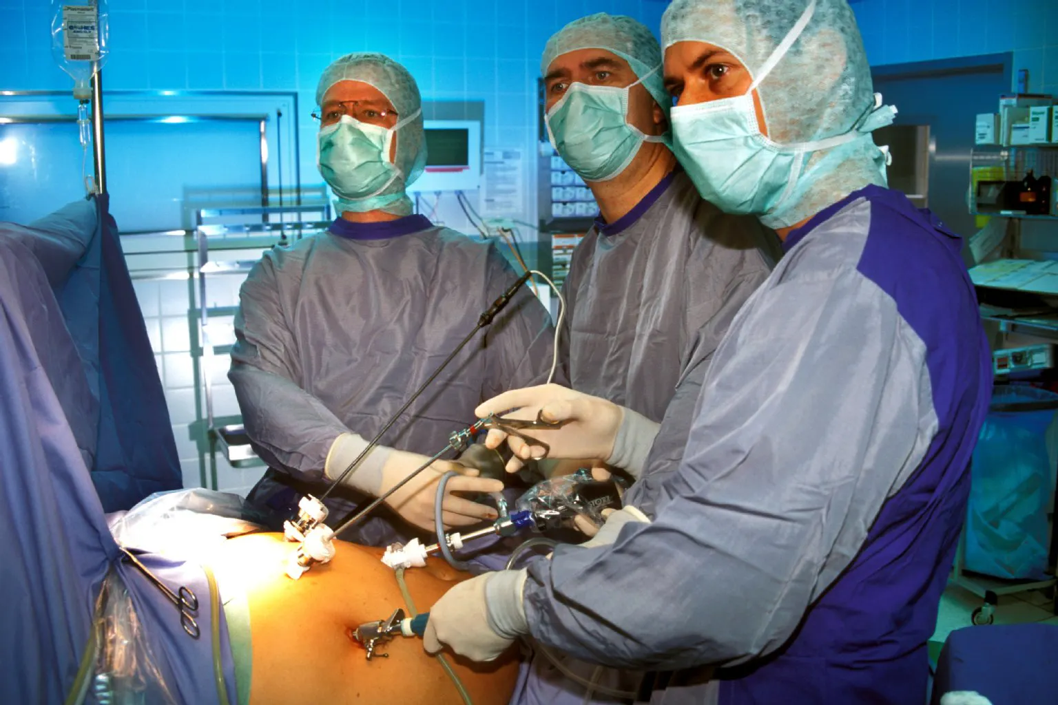 Gallensteine: Mini-OP erlöst die Patienten