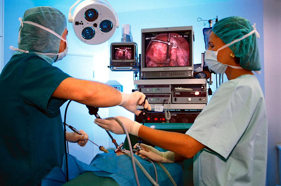 Endoskopische Operation: Der Gynäkologe (links) operiert mit Sonden durch die Bauchdecke ohne den Bauch zu eröffnen. Eine Mini-Videokamera überträgt alle Bilder aus dem Bauchraum gestochen scharf auf den Monitor.