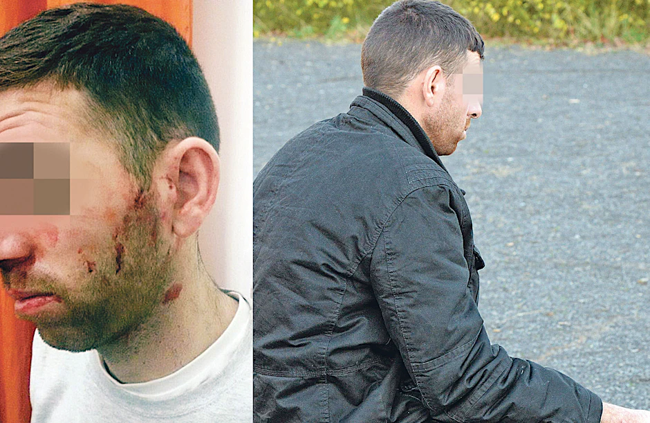 Omar K. (27) wurde am Mittwoch vor dem Lageso brutal verprügelt. Weil er die Misshandlung eines weiteren Flüchtlings nicht hinnehmen wollte.