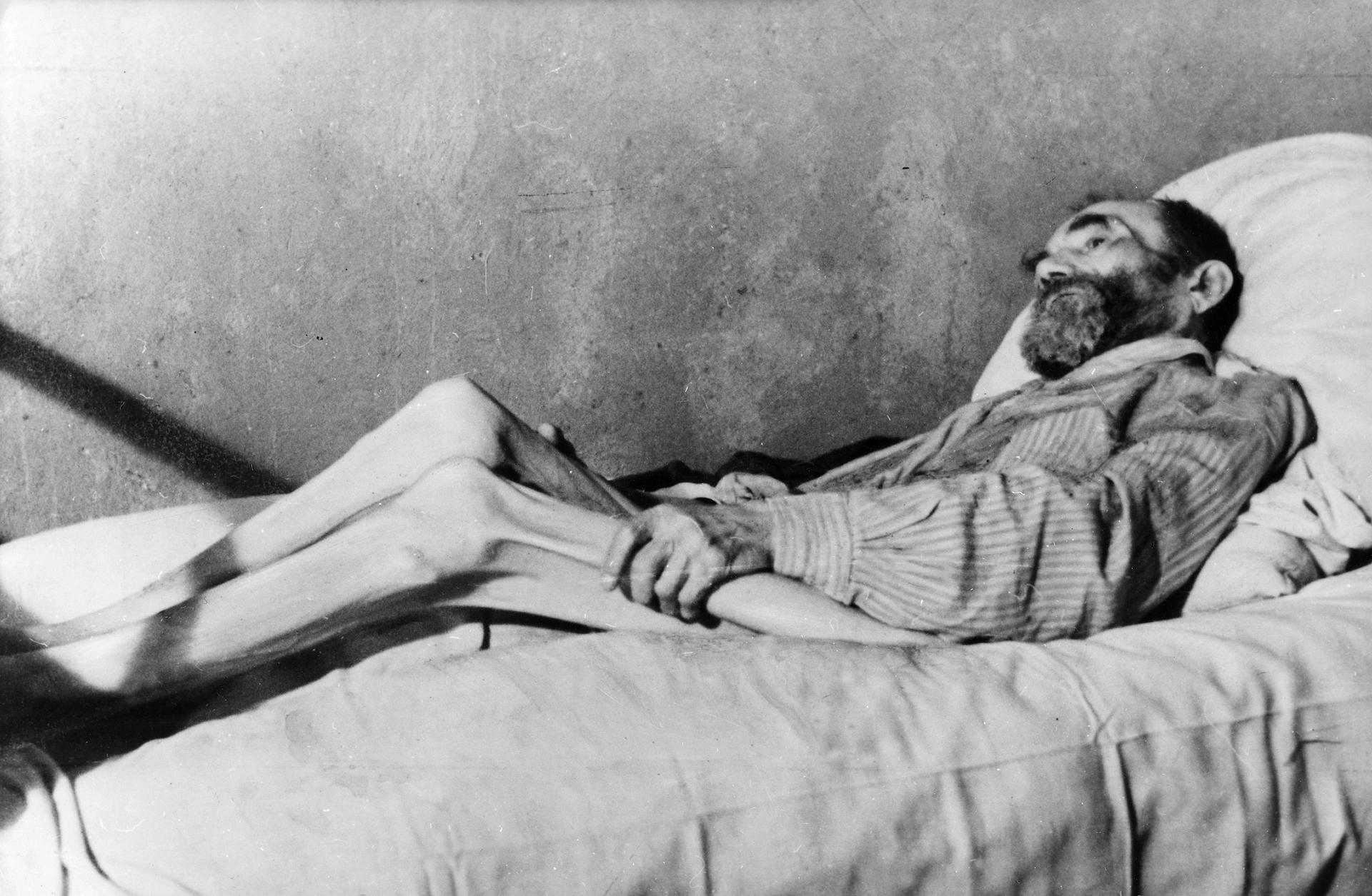 Bis auf die Knochen abgemagert liegt dieser Mann im Februar 1947 in einem Krankenhaus in Berlin.