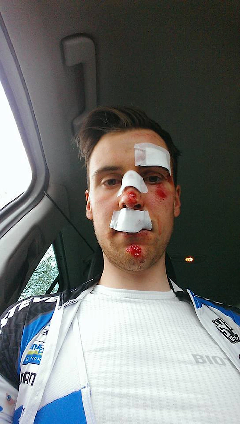 So sah Felix Donath nach dem Auto-Aufprall aus: Nase gebrochen, Wunden im Gesicht.