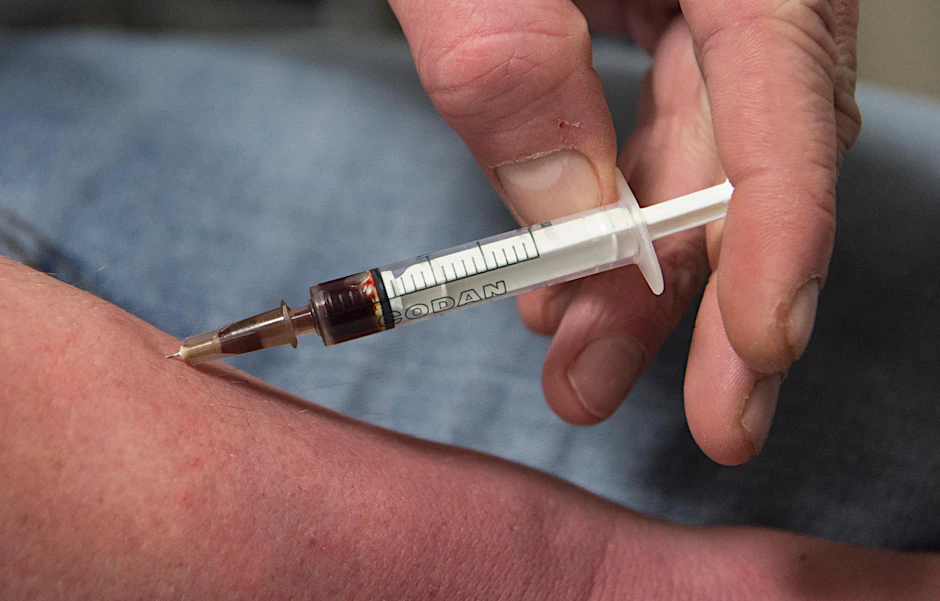 Ein Drogenkonsument spritzt sich Heroin. 