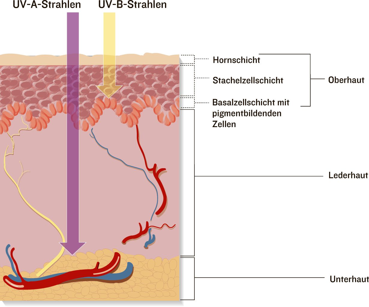 UV-A-Strahlen sind zwar schwächer als UV-B-Strahlen, dringen aber bis in die Unterhaut ein. Sie können Sonnenbrand auslösen und Krebs verursachen.