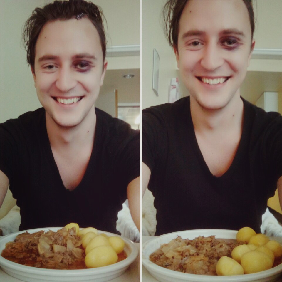 Erik bloggt über sein Schicksal (rummelschubser.de) und überrascht  mit seinem positiven Umgang  mit der Krankheit.  Hier zeigt er sein Essen in der Klinik. 