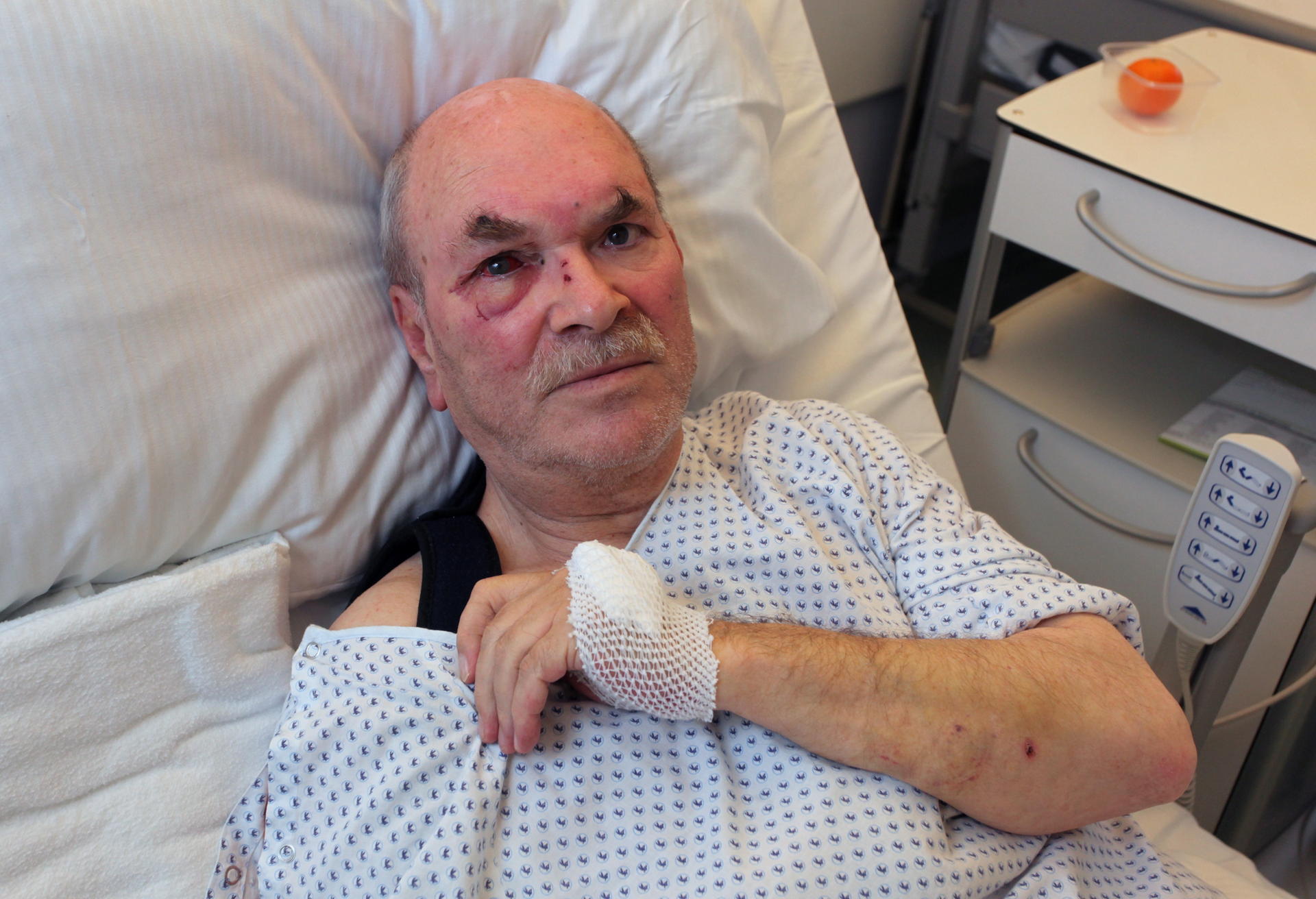 Image - Rad-Rambo-Überfall in Friedrichshain: 75-Jähriger wird dreimal ins Gesicht getreten