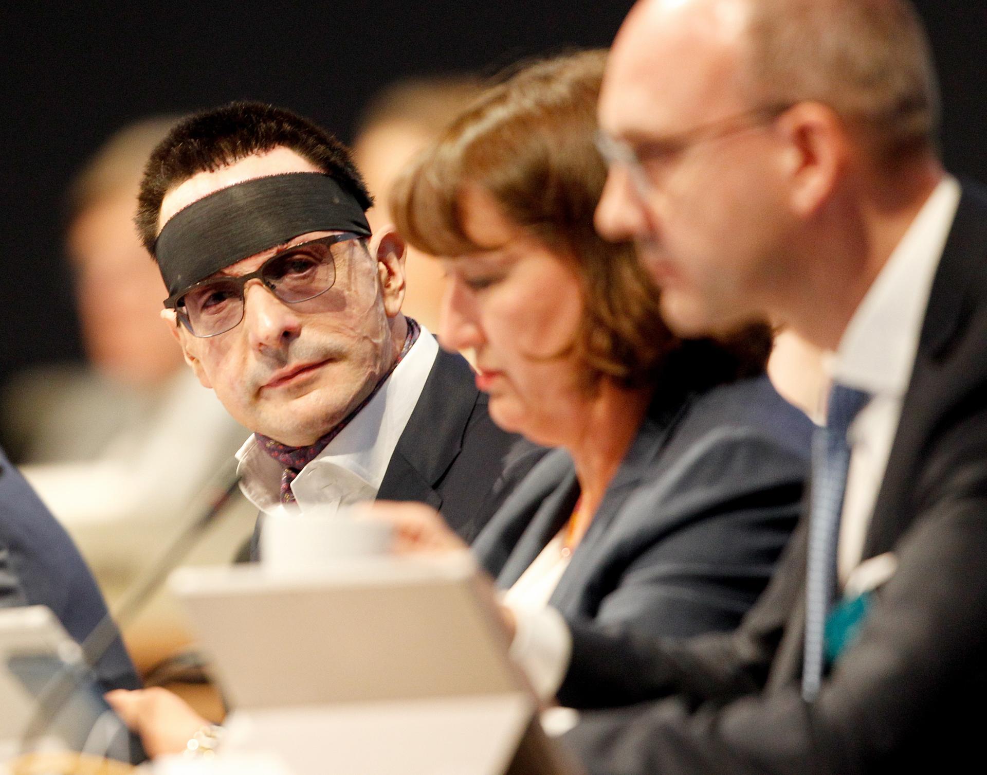 Image - Festnahme nach Säure-Attacke auf innogy-Manager Bernhard Günther, Verdächtiger soll Hells Angels-Mitglied sein