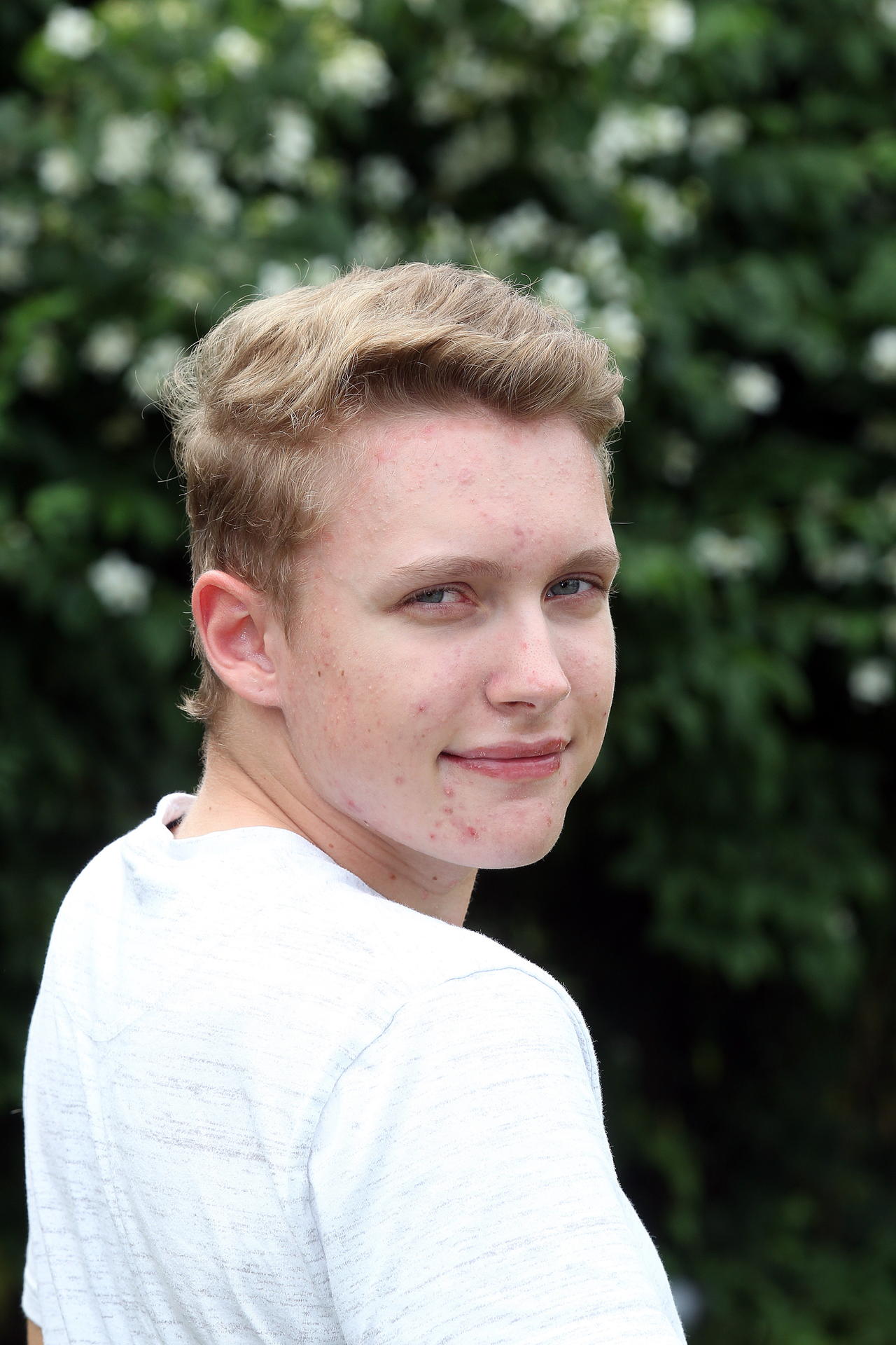Heute heißt Lisa Tony. Den Namen hat er mit seiner Mutter und seinem Bruder zusammen ausgesucht und bereits bei der Behörde geändert.  