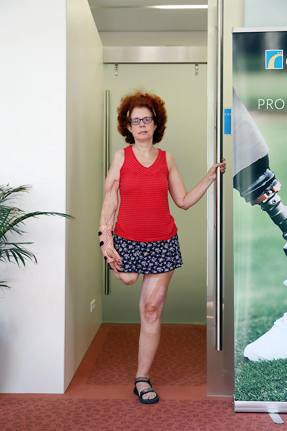Früher radelte Beate Flanz 20.000 Kilometer im Jahr. Nun braucht sie einen Rollstuhl.