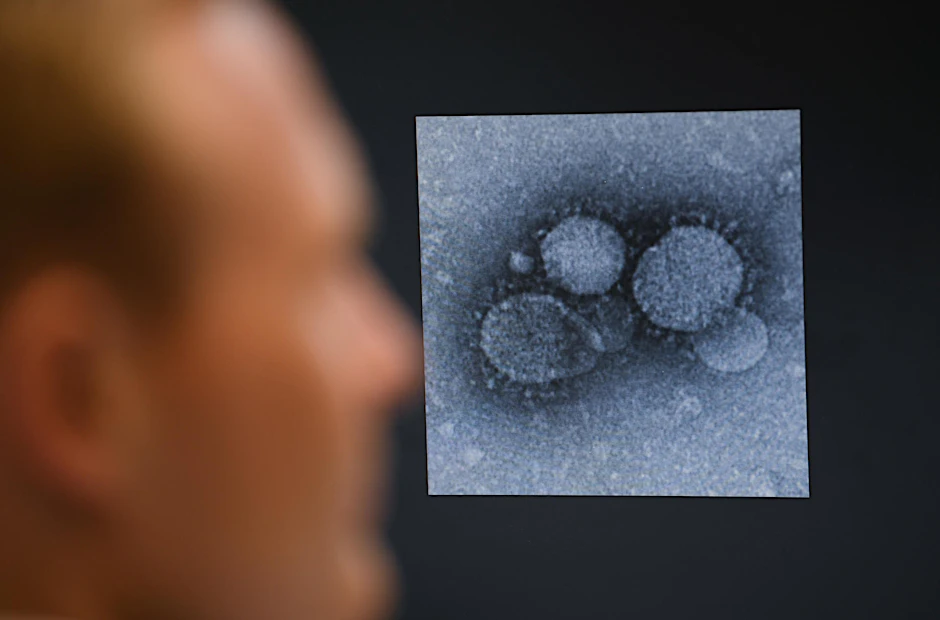 Unter dem Mikroskop: Der MERS-Coronavirus, ein enger Verwandten des neuartigen Coronavirus. 