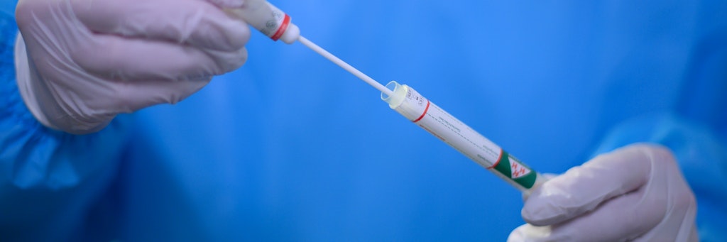 Ein Arzt hält in der Corona-Teststation für Urlaubsrückkehrer am Flughafen Dresden einen Coronavirus-Test in den Händen. 
