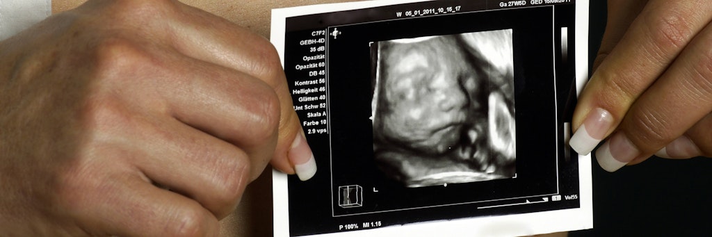 Eine Frau hält ein Ultraschallbild eines Baby in den Händen (Symbolbild).