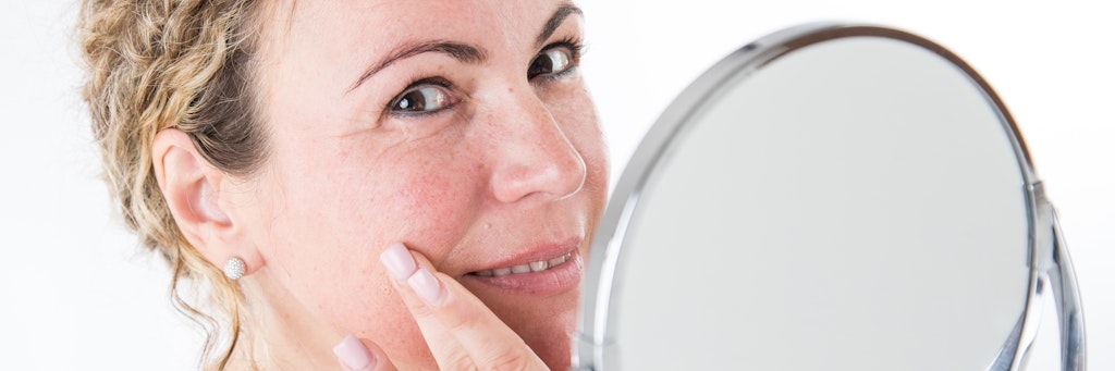 Rötungen im Gesicht sind ein erstes Anzeichen von Rosacea.