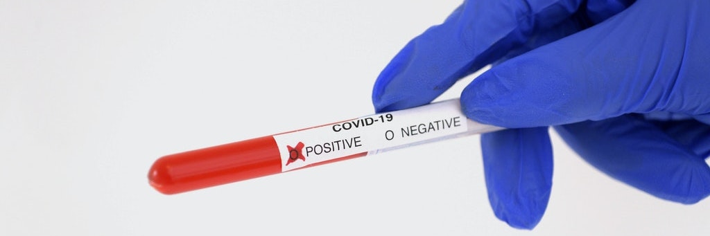Der sogenannte Ct-Wert wird bei Corona-Tests ermittelt.