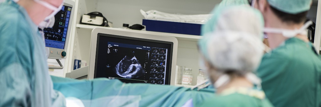 Heart surgeons and operating room nurse looking at monitor model released Symbolfoto property released PUBLICATIONxINxGERxSUIxAUTxHUNxONLY MWEF000067
