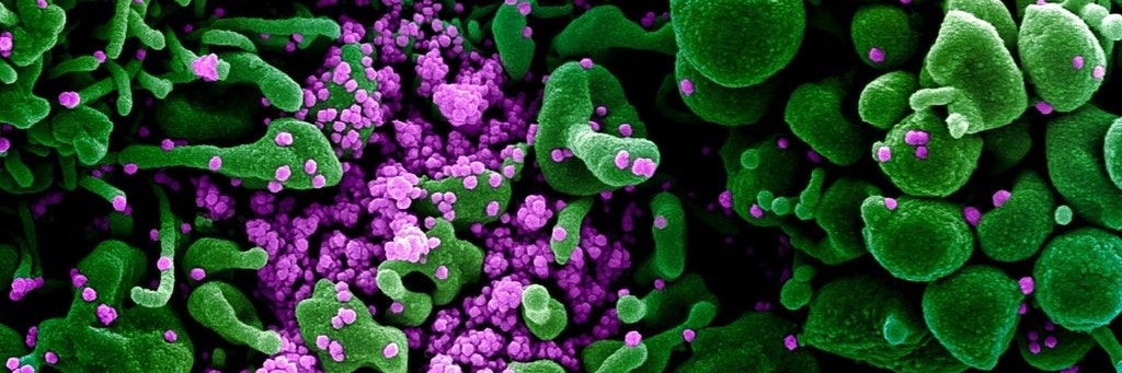 Eine Zelle (grün) ist mit dem Coronavirus (violett) infiziert.