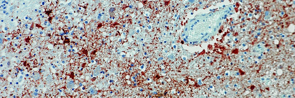 Die Aufnahme zeigt einen Anitkörpernachweis zum Borna-Virus im Gewebe. Lange war die Borna-Krankheit nur von Nutztieren bekannt.