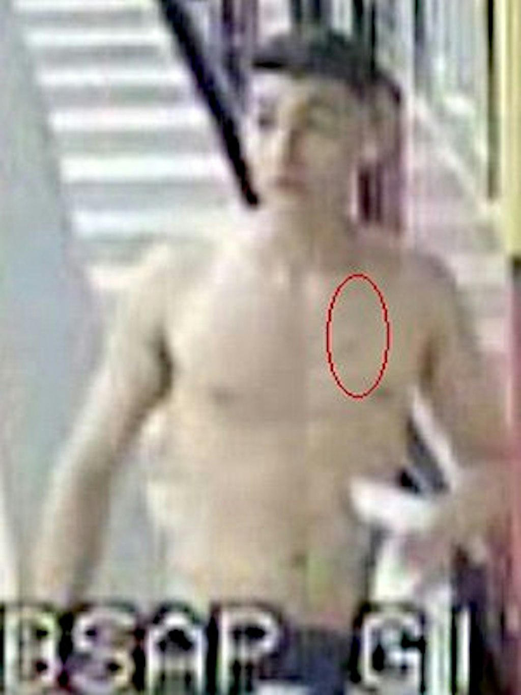 Die Ermittler haben auf diesem unscharfen Bild eine mehrere Zentimeter lange Narbe erkannt.