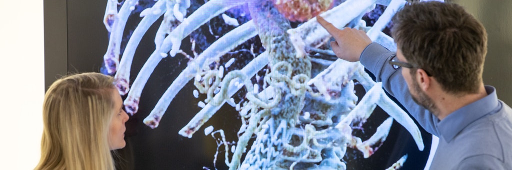 Ein menschlicher Oberkörper ist mit der 3D-Visualisierungstechnologie Cinematic Rendering dargestellt. Die Daten wurden mithilfe von Röntgenstrahlung gewonnen. 