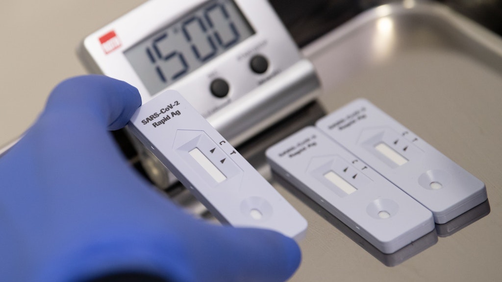 Ein Antigen-Schnelltest: Auf dieser Kassette wird die Probe aufgebracht, die nach 20 Minuten anzeigt, ob eine Corona-Infektion vorliegt.