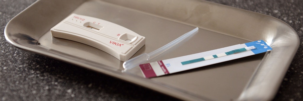 Ein Syphilis-Schnelltest und ein HIV-Test liegen im Labor der Aids-Hilfe.
