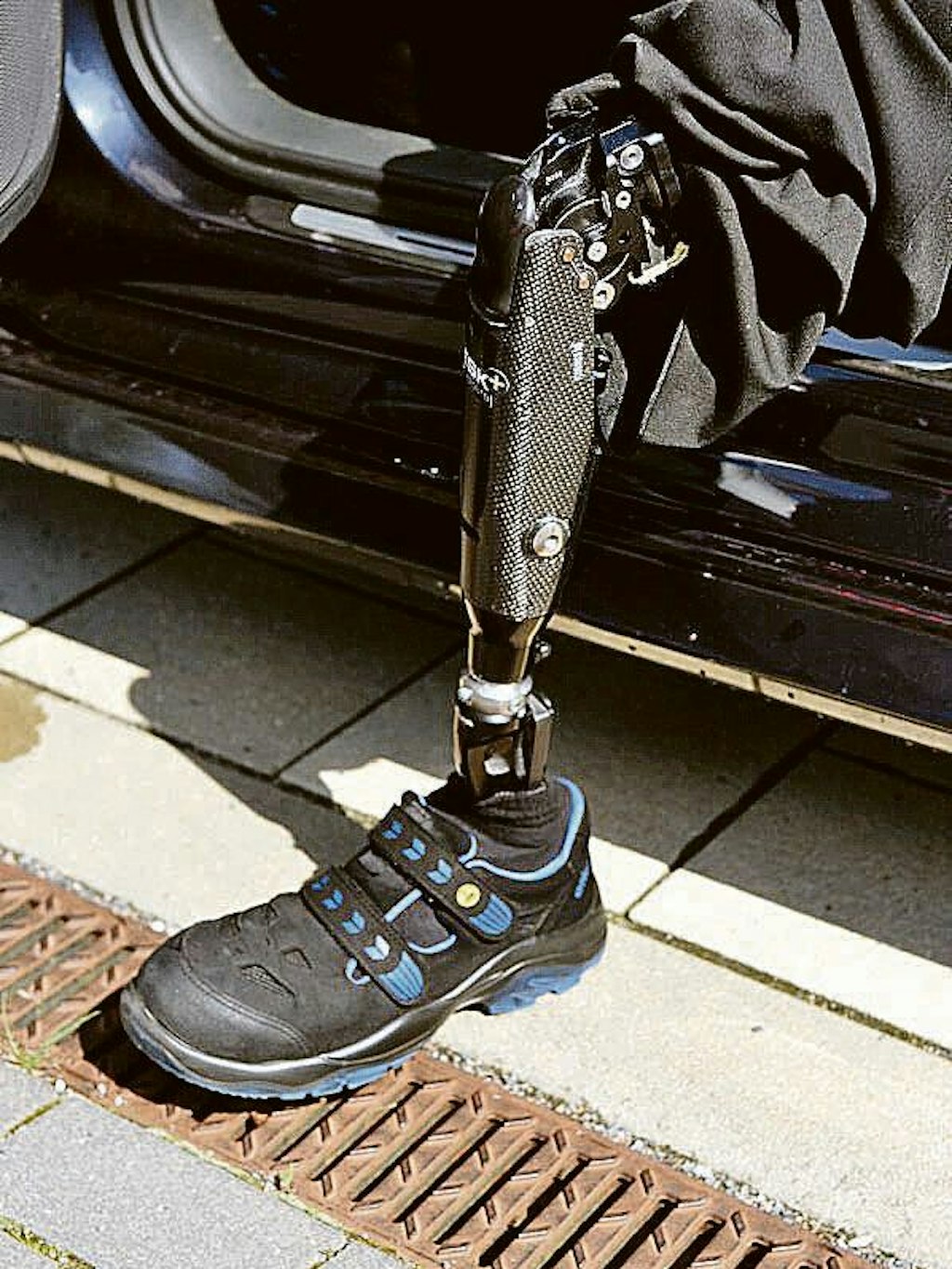 Diese Standardprothese erschwerte Dietmar Glombitza zusätzlich das Leben, weil er immer wieder damit stürzte und auch keine Treppen steigen konnte. Nach einem Gerichtsverfahren zahlt ihm seine Krankenkasse nun endlich eine alltagstaugliche Prothese.