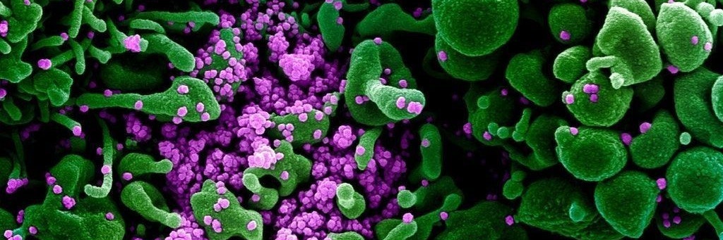 Eine Zelle (grün) ist mit dem Coronavirus (violett) infiziert.