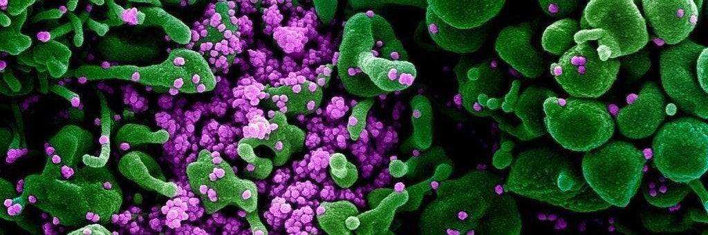 Eine Zelle (grün) ist mit dem Coronavirus (violett) infiziert.