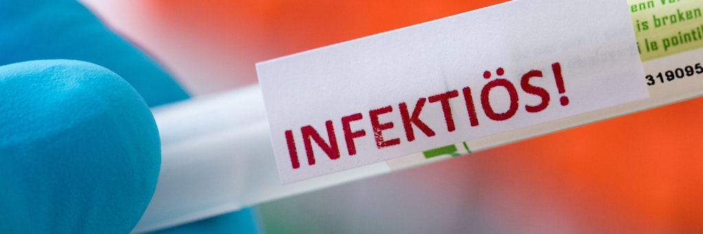 Bei mehreren größeren privaten Feiern haben sich in Göttingen mehrere Menschen mit dem neuartigen Coronavirus infiziert.