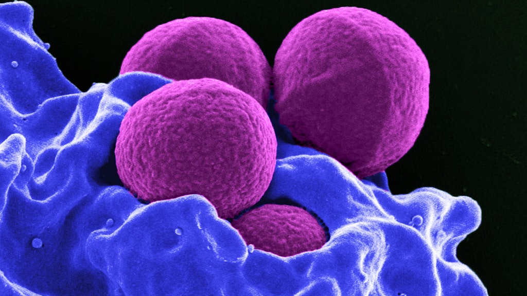Multiresistente Keime unter dem Rasterelektronenmikroskop. Sie rufen Infektionen hervor, gegen die keine Antibiotika mehr helfen.