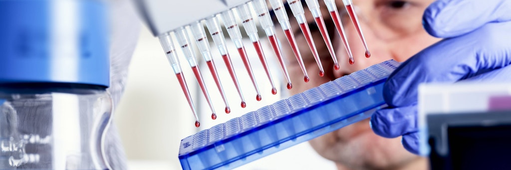 Bluttest in einem Labor zur Erkennung von Tumormarkern im Blut.