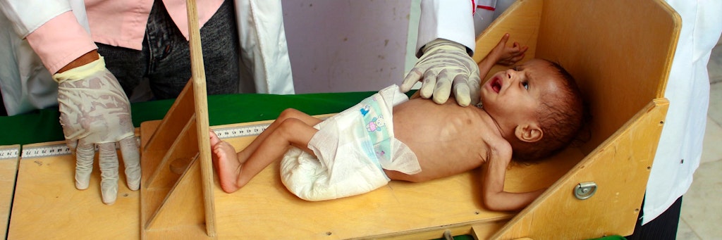 Jahrelanger Krieg, eine Cholera-Epidemie und jetzt noch Corona – deshalb greift der Hunger im bitterarmen Jemen um sich.