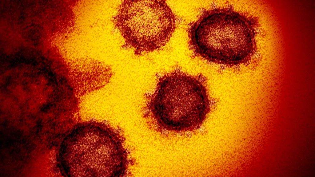 Eine Elektronenmikroskop-Aufnahme zeigt das Coronavirus SARS-CoV-2, das die Lungenkrankheit Covid-19 auslöst.