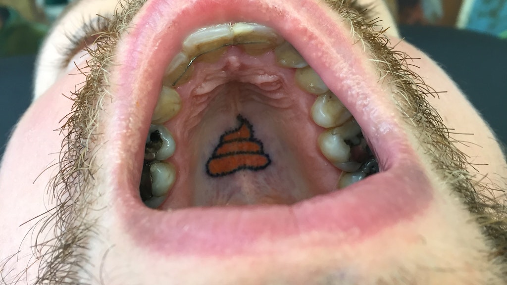 Blick auf einen Kothaufen-Emoji (im Original „Pile of Poo“ genannt) im Gaumen des Kunden Lucas. 