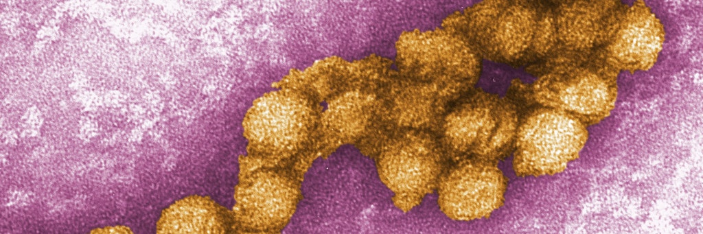 Das West-Nil-Virus unter dem Elektronenmikroskop<br>
