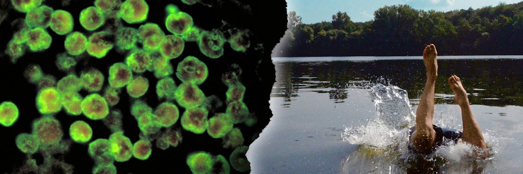 Die „Naegleria fowleri“ verursachen Hirnhautentzündungen, könnten von Juli bis September in Gewässern sein.