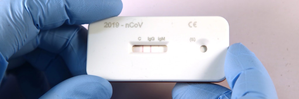Ein Wissenschaftler zeigt einen Corona-Schnelltest (Symbolfoto).