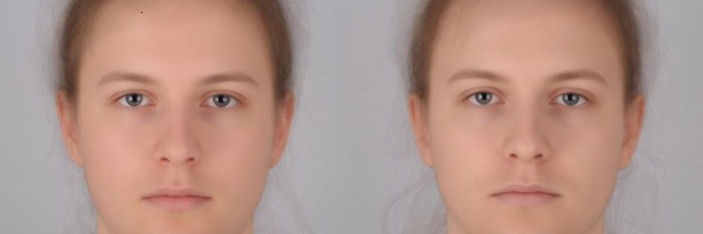 Die Grafik zeigt die übereinandergelegten Porträts derselben Teilnehmer, denen ein Placebo (l.) oder eine E.-coli-Bakterienkomponente (r.) injiziert wurden. Die Bilder wurden zwei Stunden nach der Injektion aufgenommen.