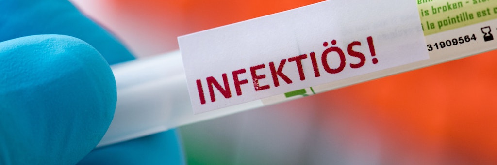 Die Gesundheitsämter in Deutschland haben dem Robert Koch-Institut (RKI) binnen eines Tages 1890 Corona-Neuinfektionen gemeldet. 