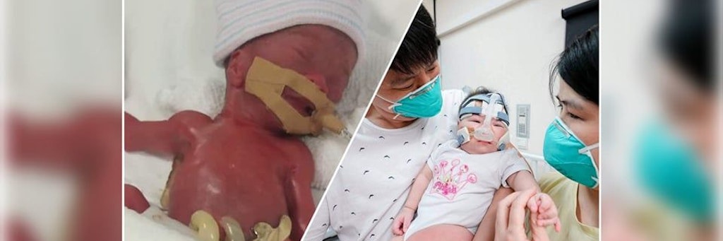 Das Mädchen, das bei der Geburt als das kleinste Baby der Welt galt, wurde nach 13 Monaten intensiver Behandlung aus einem Krankenhaus in Singapur entlassen.