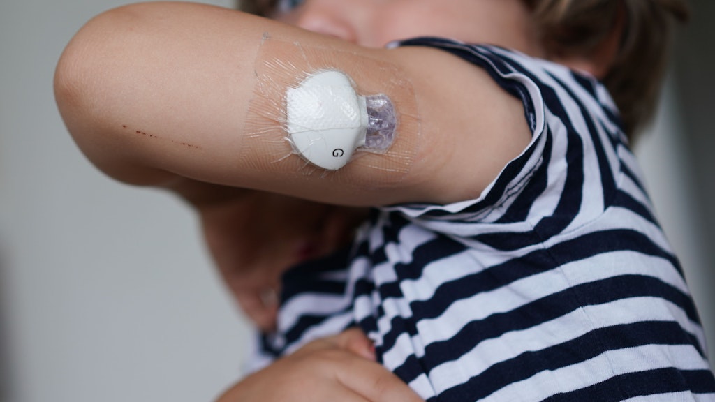 Oskar (4) zeigt einen Sensor an seinem Arm, der seinen Blutzucker misst. 