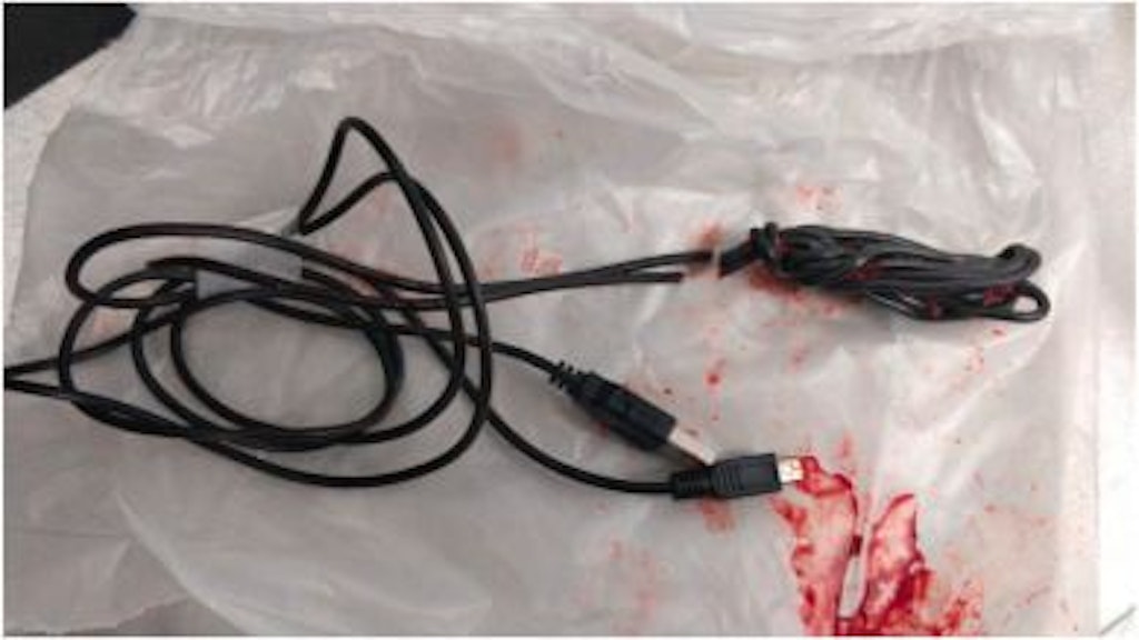 Hat im Penis eigentlich nichts zu suchen: das herausoperierte USB-Kabel.