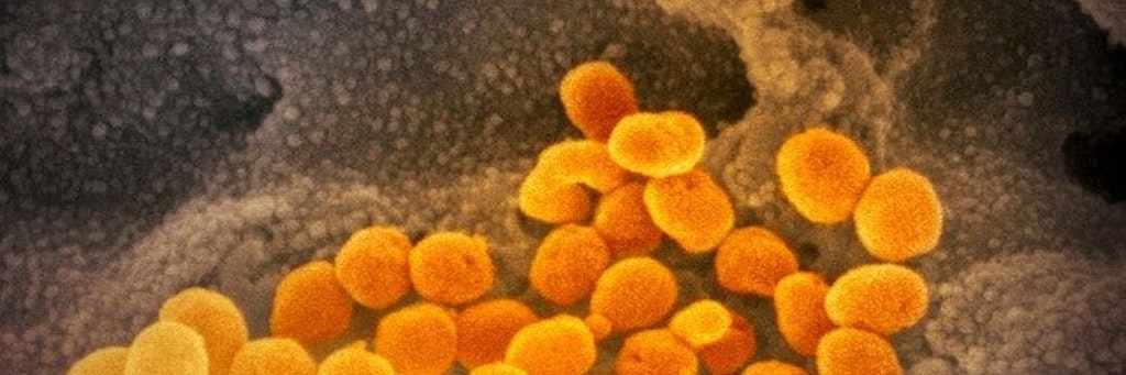 Das Coronavirus unter dem Elektronenmikroskop